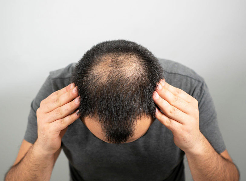 hair doctor in indore, hair specialist in indore