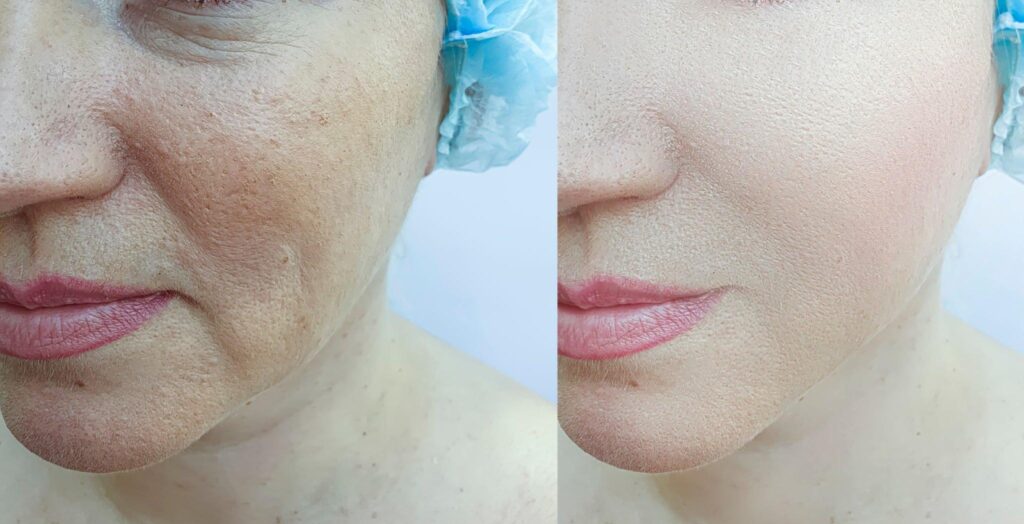 best rhinoplasty surgeon in indore, cosmetic surgeon indore, face surgery in indore