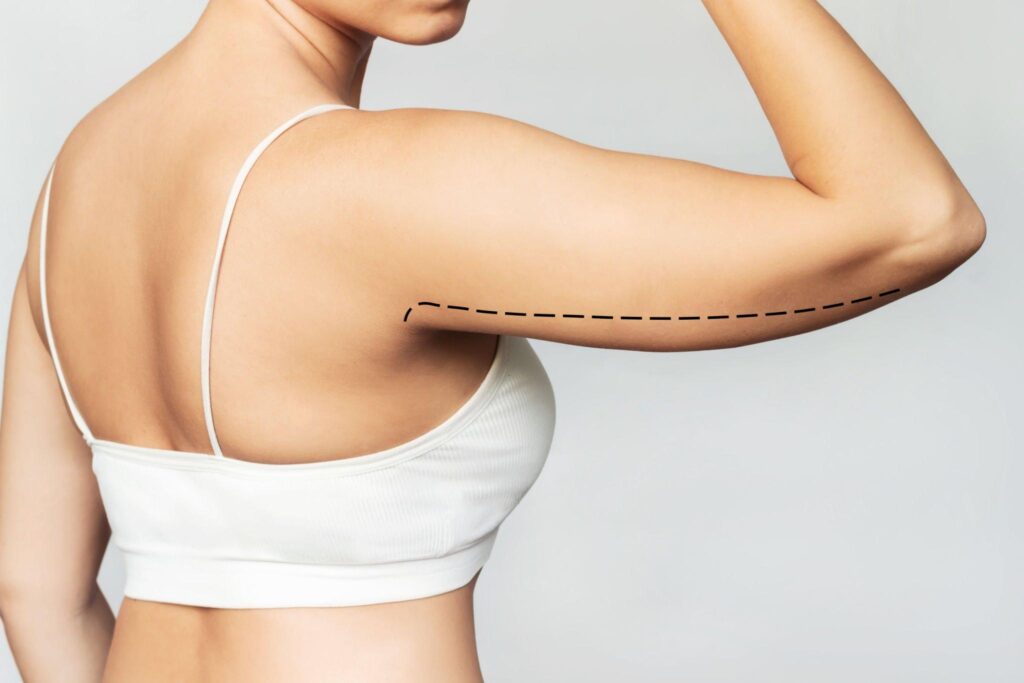 arm lisft in indore, plastic surgeon indore, plastic surgery in indore