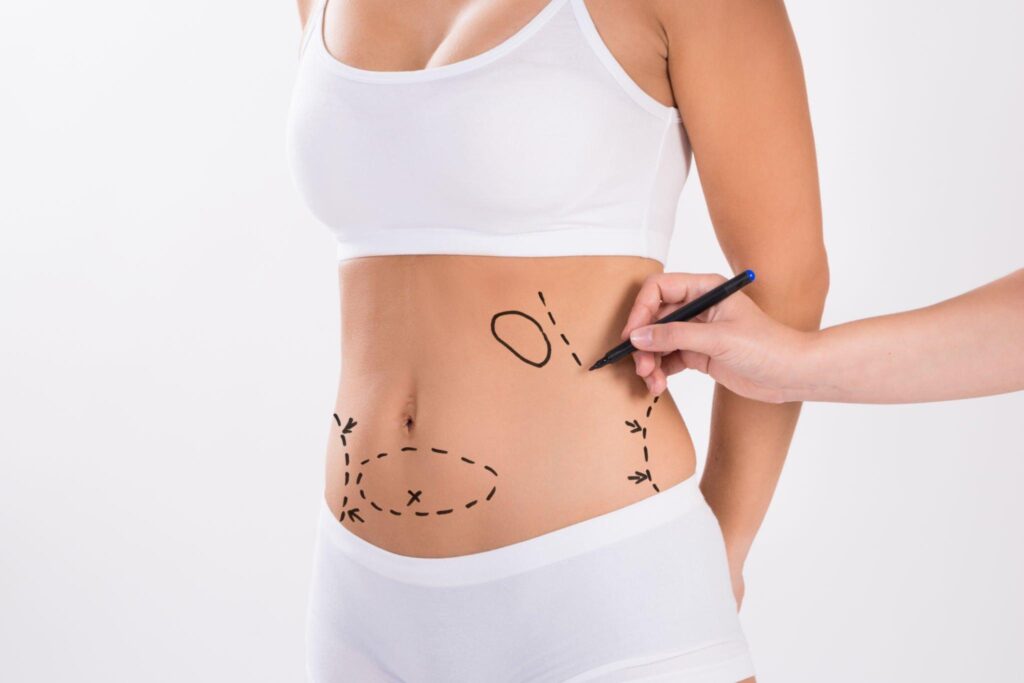 abdominoplasty in indore, plastic surgeon indore, best cosmetic surgeon in indore