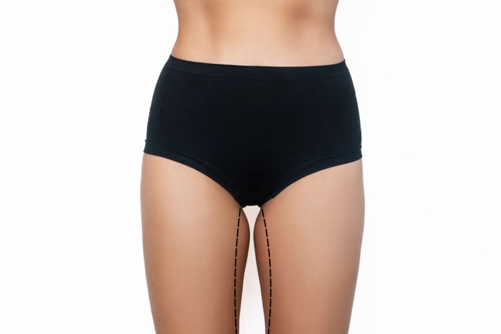 body lift in indore, plastic surgeon indore, plastic surgery in indore