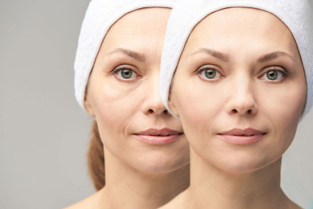 face surgery in indore, rhinoplasty surgery in indore