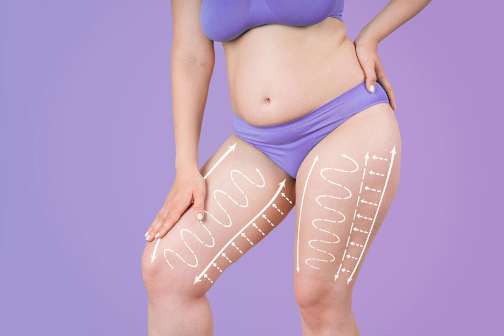 Thigh lift in indore, plastic surgeon indore, plastic surgery in indore