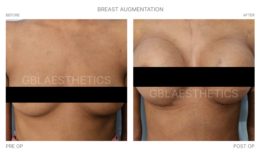 breast doctor in indore, best cosmetic surgeon in indore