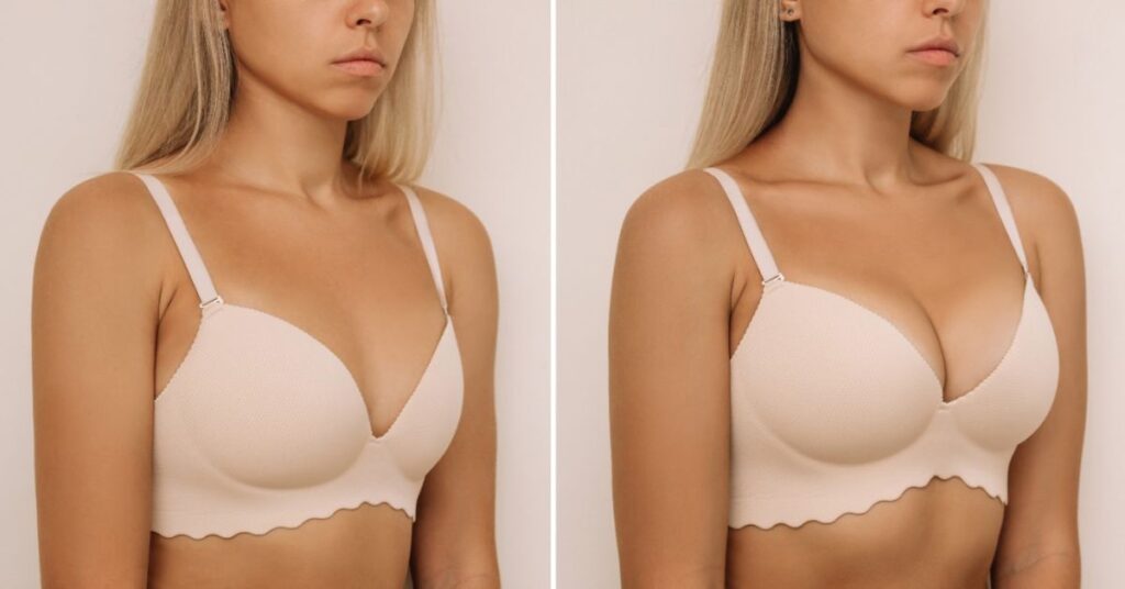 reast augmentation in indore, best breast augmentation in indore, breast reduction in indore, best breast reduction in indore, breast lift surgery in indore, best breast lift surgery in indore, breast doctor in indore, breast aesthetics in indore, breast lift doctor in indore, breast plastic surgeon in indore, breast plastic surgery in indore, breast reconstruction surgeons in indore